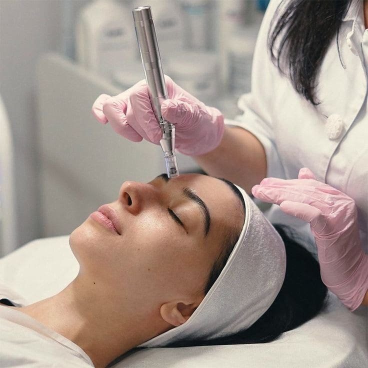 Dermapen con Silicio Orgánico — fotografía proporcionada por Mertherapy