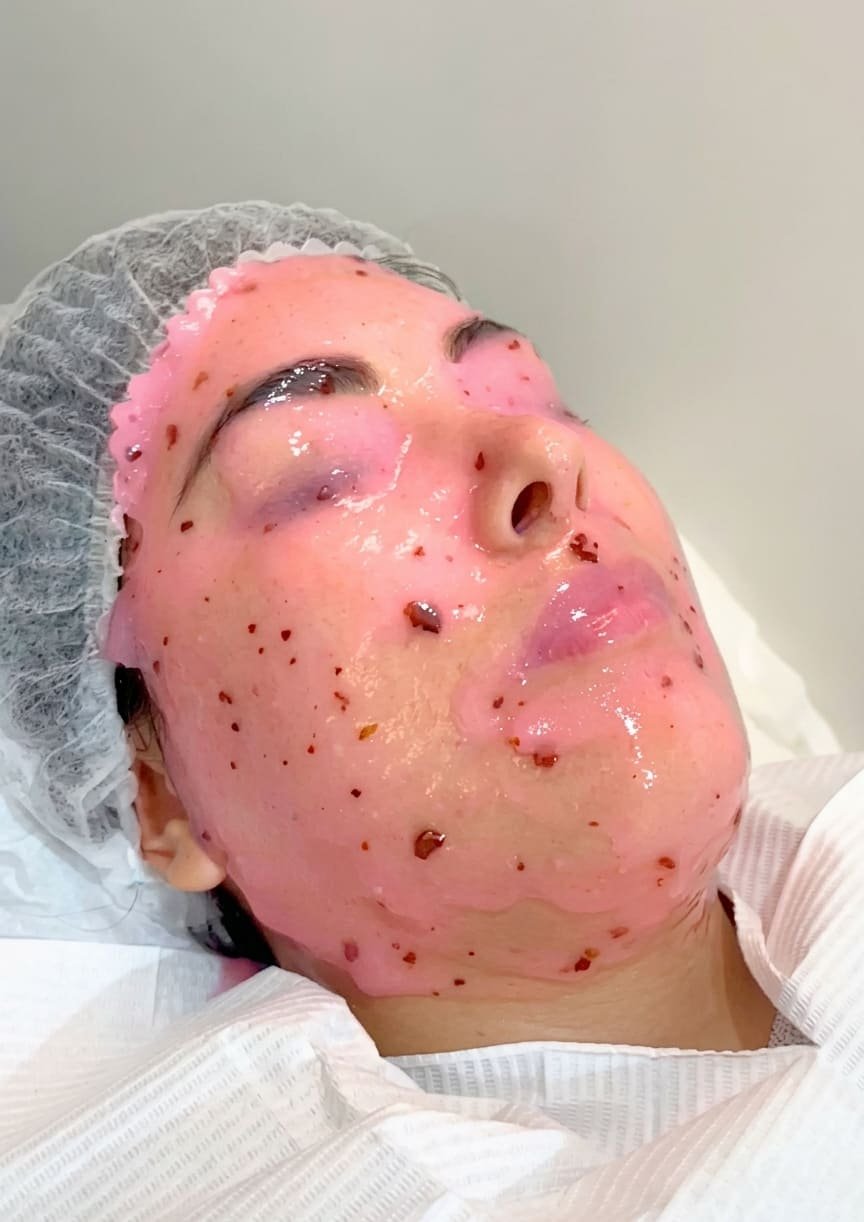 Tratamiento facial delicado en piel sensible con tendencia al enrojecimiento