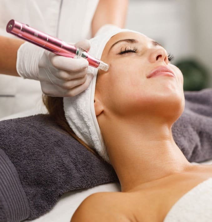 Dermapen con Amber Glow — fotografía proporcionada por Mertherapy