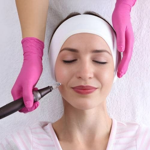 Producto de Dermapen con exosomas TRX para protocolo antimanchas