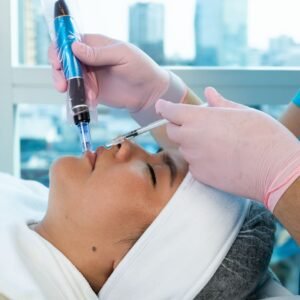 Dermapen con Vitamina C
